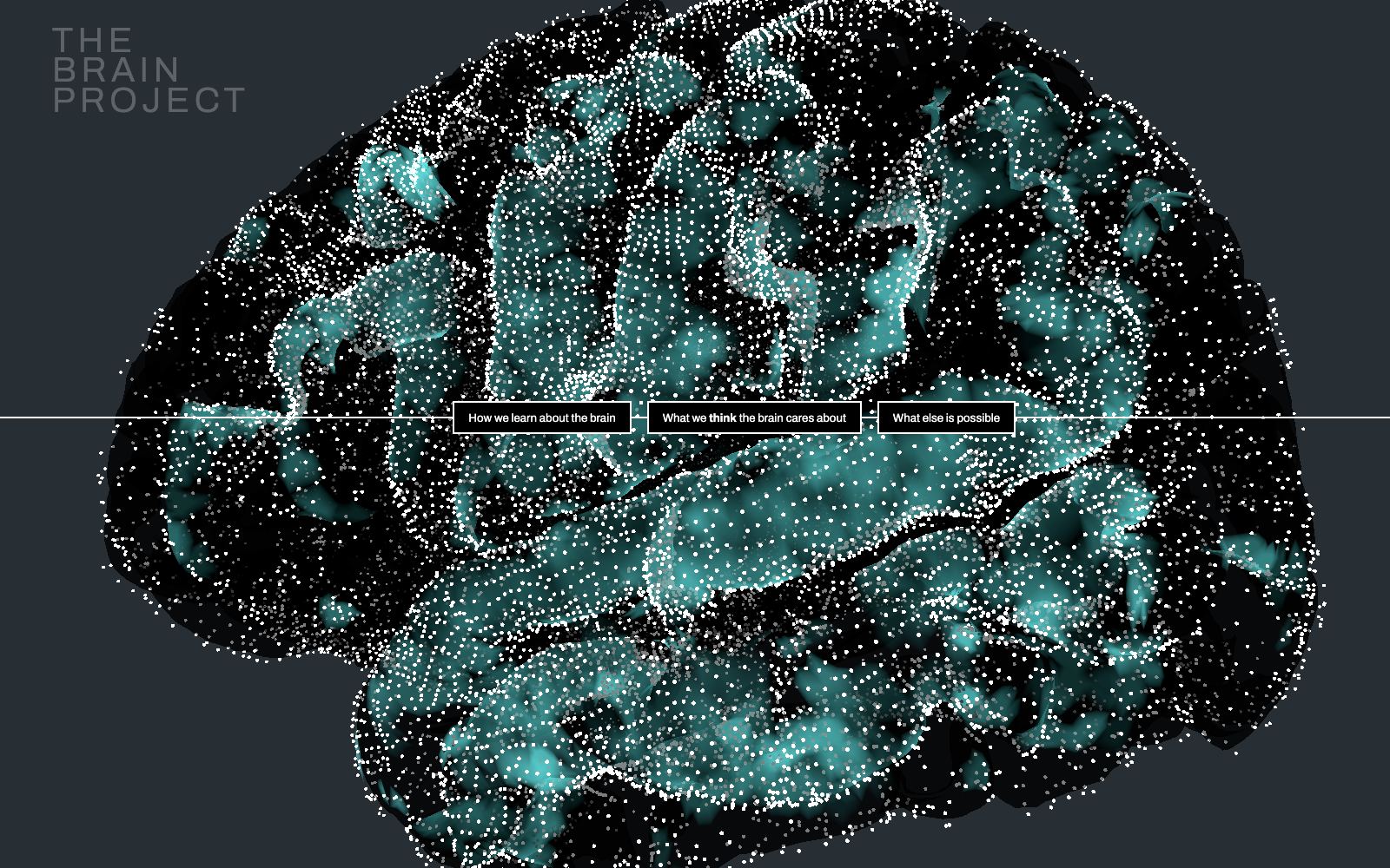 UCSF Brain Visualization